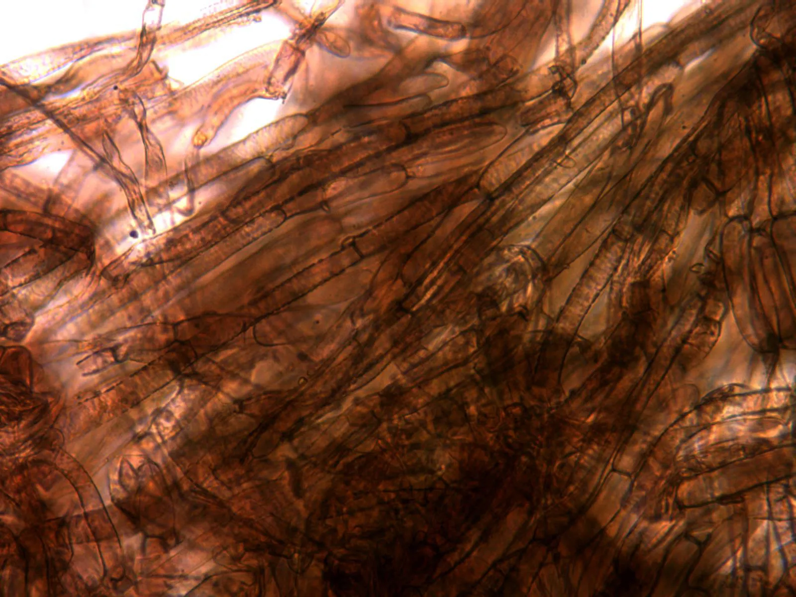 Microscopía de Inocybe malenconiana - 10 - Hifas suprapellis pigmentadas